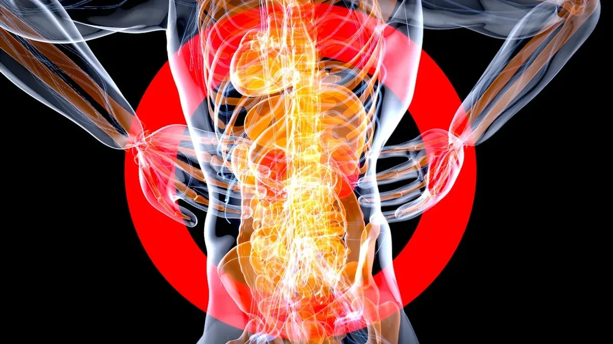 douleur musculaire dos — Douleur musculaire dos : comprendre et agir